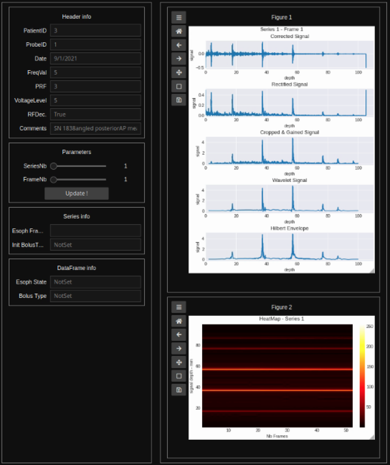 Screenshot Ultrasound FinalGUI1