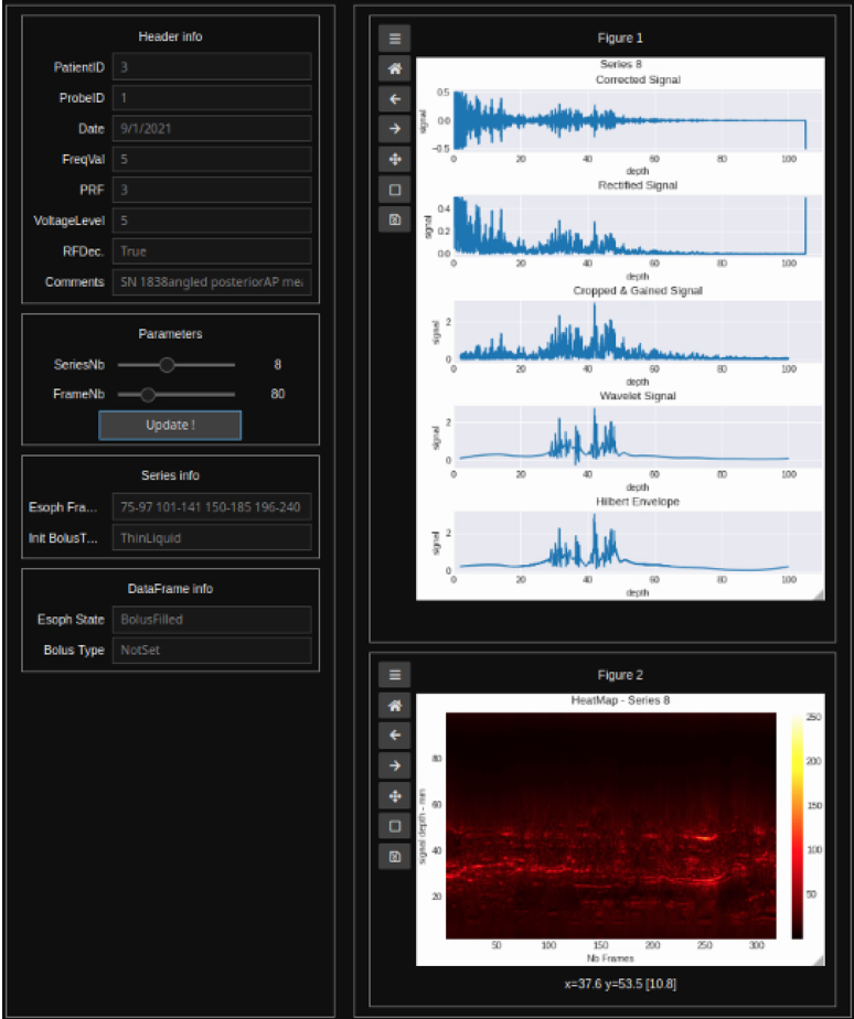 Screenshot Ultrasound FinalGUI2